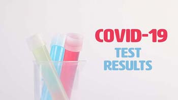 Negative Covid Test Result