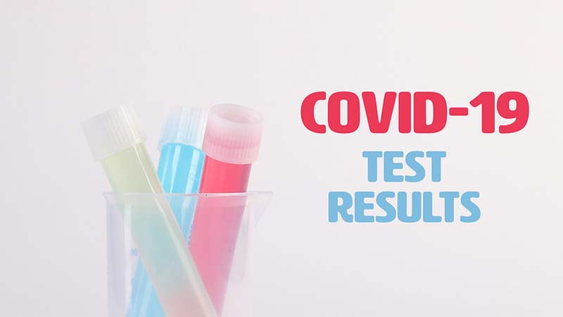 Negative Covid Test